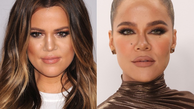 Khloe Kardashian before and after nose job